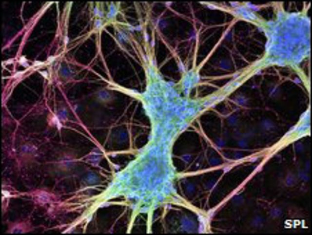 Neuronas