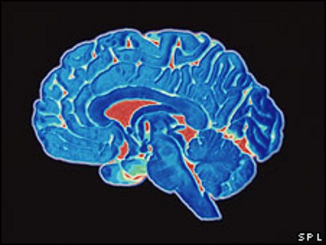 Trastornos de etiología orgánica: Demencias, Enfermedad de Parkinson,  Enfermedad de Niemann-Pick, Enfermedad de Huntington