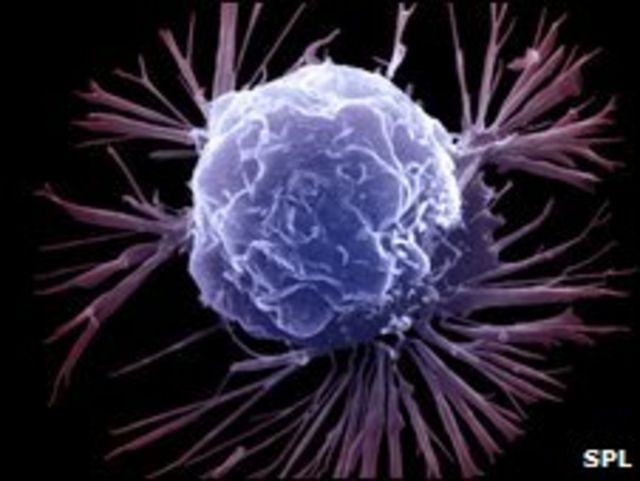 صورة مجهرية لخلية سرطانية