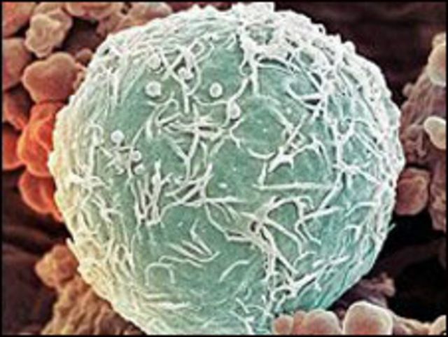 خلايا سرطان اللوكيميا