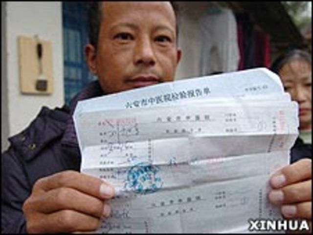 安徽霍山縣醫院血液透析病人孫志龍在展示部分丙肝抗體陽性檢驗報告單（新華社圖片9/12/2009）