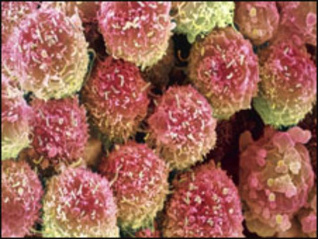 خلايا سرطان الرئة