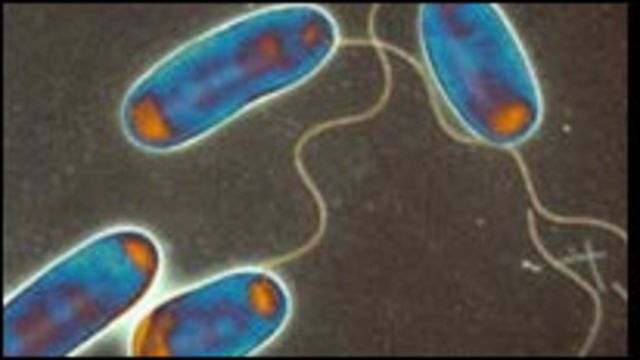 Bakteri legionella