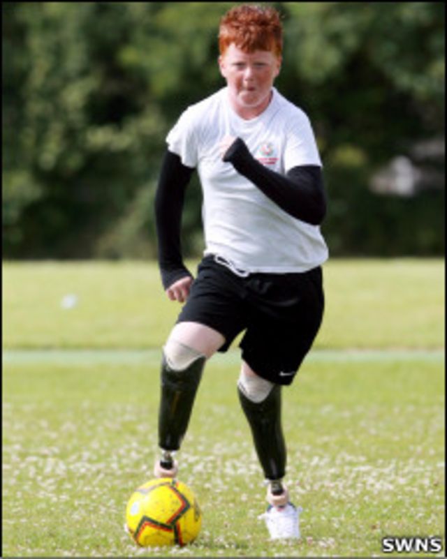 Atleta britânico se machuca em jogo de futebol e descobre câncer na perna