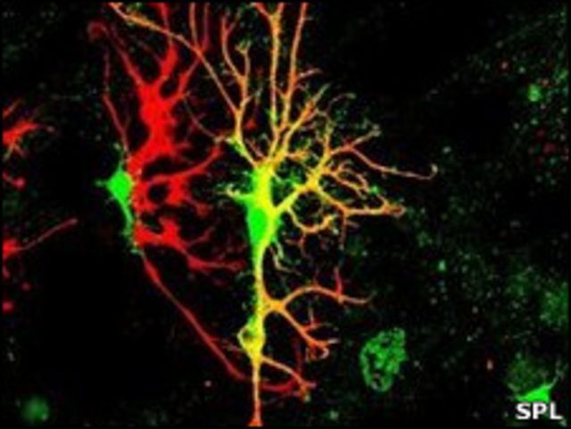 Neuronas