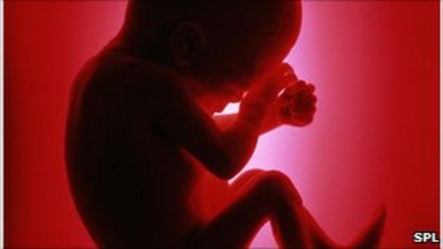 Hamilelikte Beslenme Bebegin Dna Sini Degistiriyor Bbc News Turkce