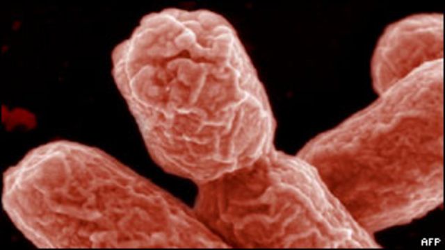 Cabeza Familiarizarse Coordinar El síndrome letal causado por la bacteria E. coli - BBC News Mundo