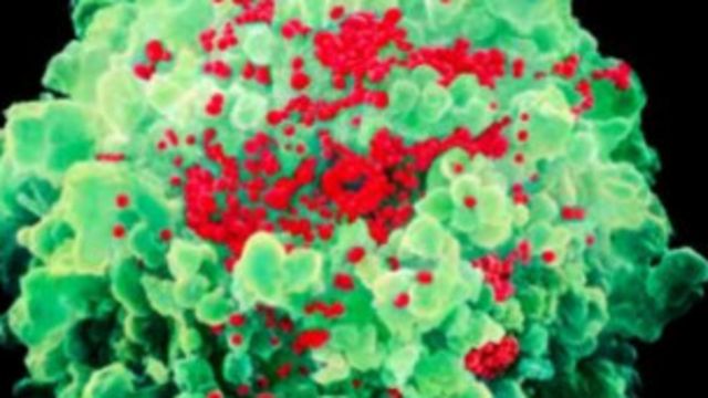 Virus VIH infectando una célula 