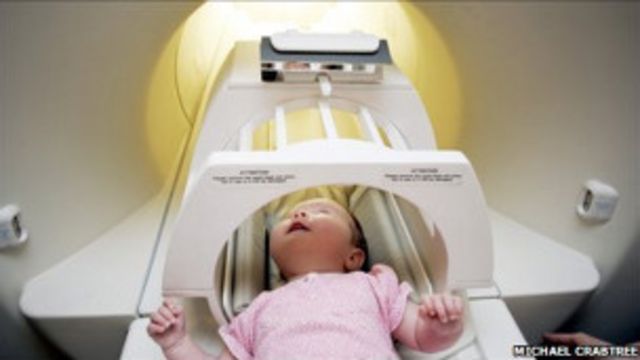 3 Aylik Bebekler Sesteki Duygulari Sezebiliyor Bbc News Turkce