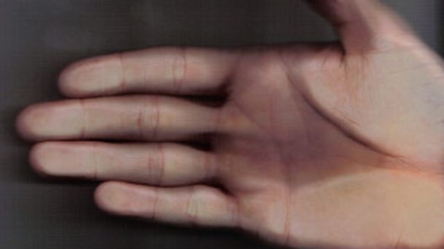 Yemas de los dedos agrietadas: causas y tratamiento