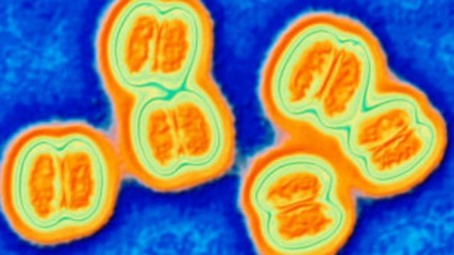 Hallan Compuesto Para Combatir La Meningitis Bbc News Mundo 9822