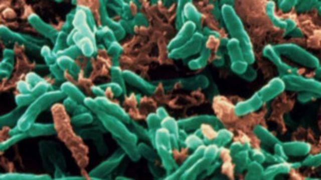 Des bactéries de la tuberculose pourraient être vite détectées ...