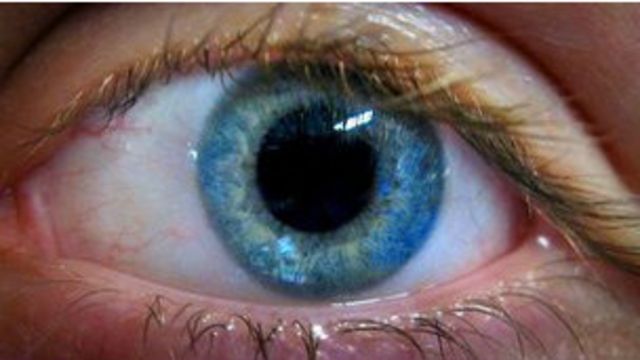 tifón Enderezar Debe Terapia de láser que cambia el color de ojos - BBC News Mundo