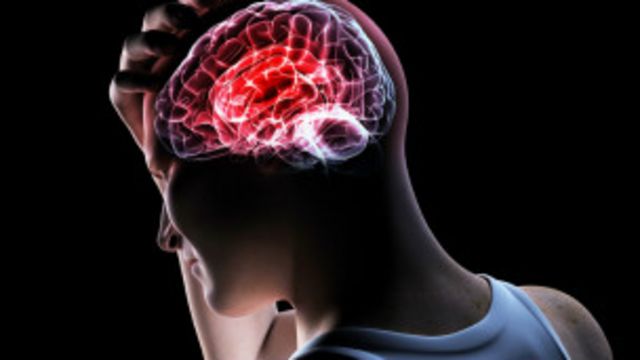 El Tratamiento Mas Efectivo Contra La Esclerosis Multiple Bbc News Mundo