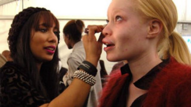 Modelos albinas contra la discriminación en África - BBC News Mundo
