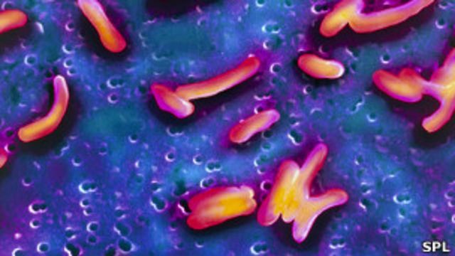 Bacteria del cólera