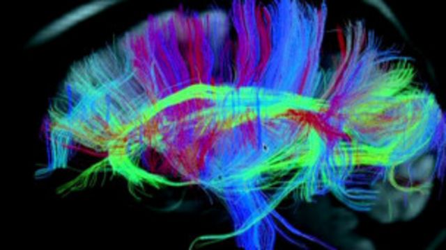 العلماء يقرأون الأحلام من خلال المسح الضوئي على المخ Bbc News عربي