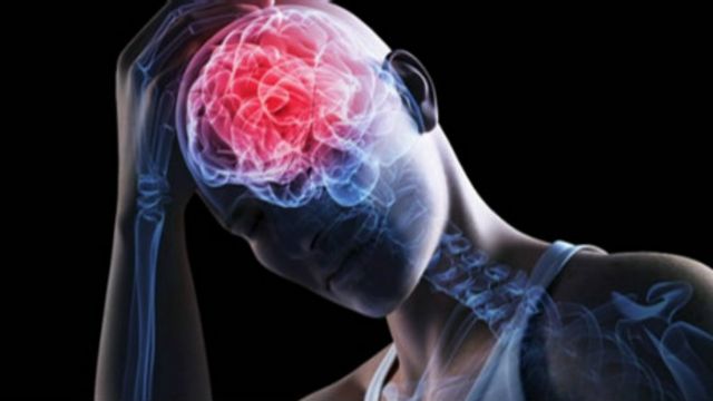 Derrame cerebral: mucho peor en las mujeres - BBC News Mundo