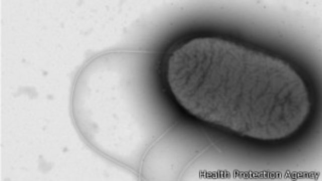 (Foto: Health Protection Agency)