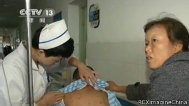英媒 中国医生地位低 常挨打骂 c News 中文 英媒 中国医生地位低 常挨打骂 c News 中文