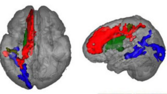 Сканирование мозга детей
