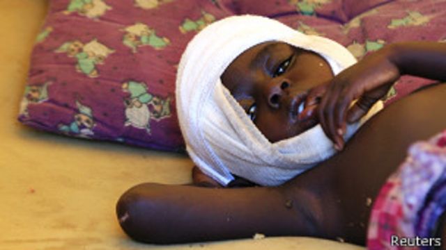 南苏丹受伤儿童
