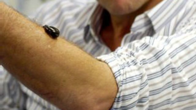 مذيع بي بي سي يبتلع الديدان في محاولة لاكتشاف تأثير الطفليات على جسم الإنسان Bbc News عربي