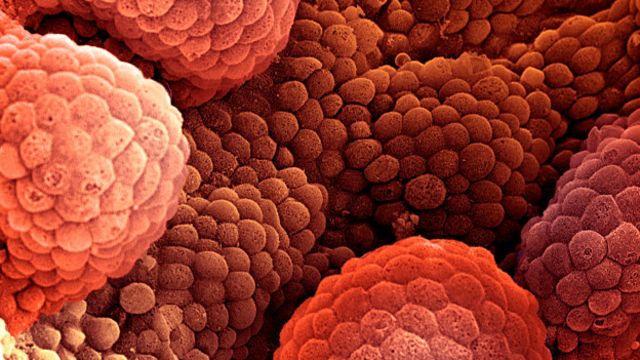 Em geral, corpo não reconhece tumor como inimigo, porque ele se desenvolvem a partir de células saudáveis. A nova técnica pretende alterar essa lógica