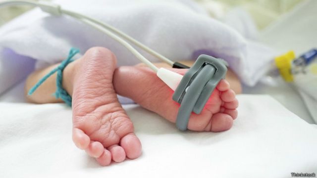 El Dia Mas Peligroso En La Vida De Un Bebe Prematuro c News Mundo