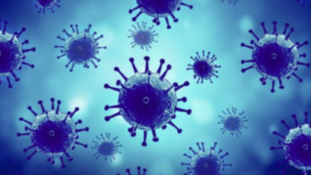 HIV AIDS