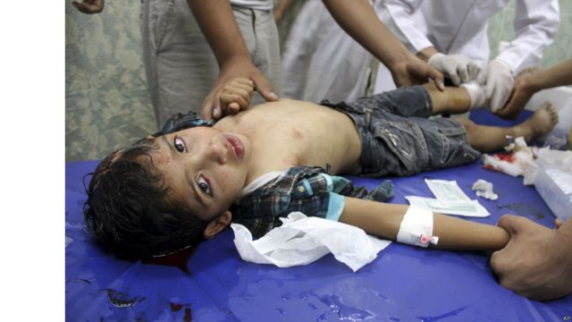 一名巴勒斯坦兒童在以色列的攻擊中受傷，被送往醫院治療。