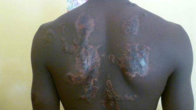 Serikali ya Nigeria bado haijasema chochote kuhusu madai ya Amnesty International