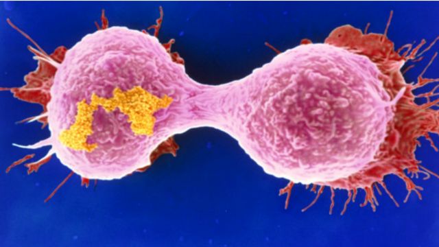 Células cancerígenas (BBC)