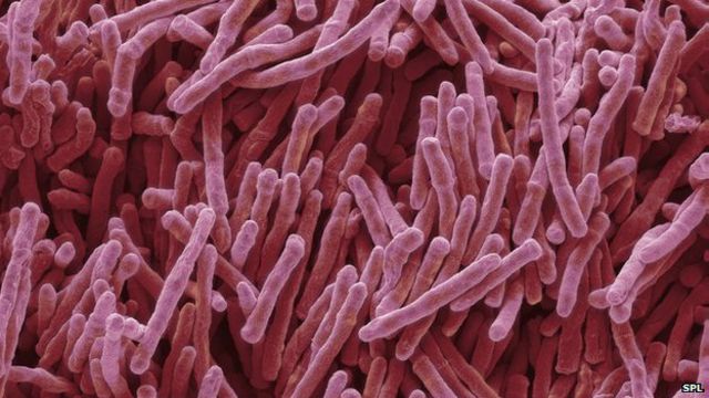 Em testes feitos em ratos de laboratório, medicamento foi eficaz no combate a bactérias resistentes