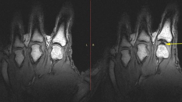 Mengapa Buku Jari Dapat Berbunyi c News Indonesia