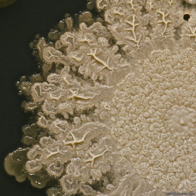 A especialista acredita que este micróbio seja um estafilococo.