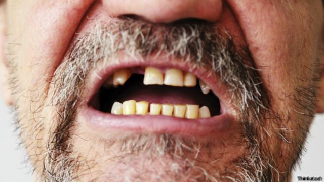 Чем опасны гнилые зубы и как их лечить