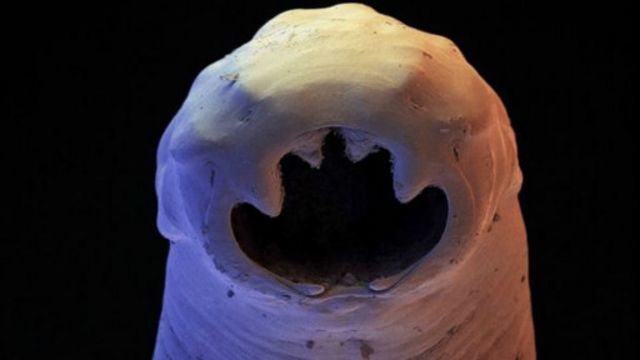 Le sympathique Ankylostome s'accroche à l'intestin en utilisant ses dents