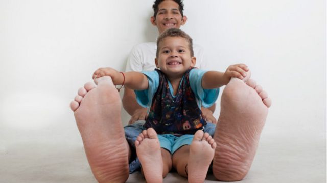 El venezolano que tiene el pie más grande - BBC Mundo
