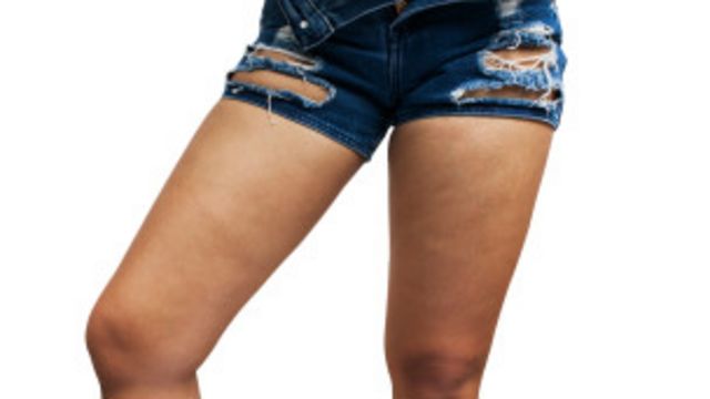 celulitis y shorts