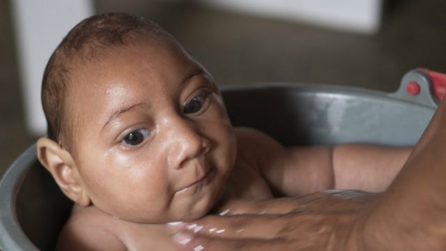 Virus del Zika