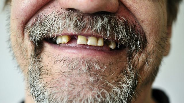 Зубной Человек Фото