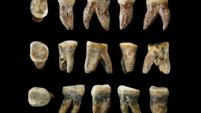 Суровая стоматология в Древнем Риме / стоматология :: зубы