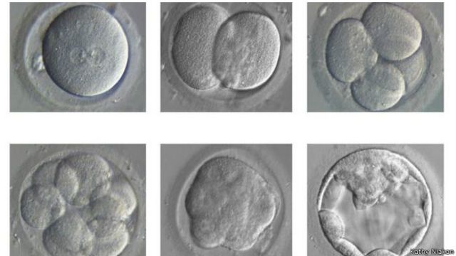 Ученые вырастили почти человеческий эмбрион. 