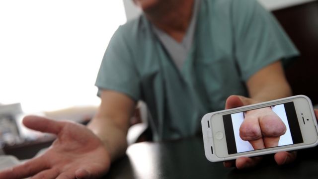 Un cirujano plástico muestra la foto de una mujer con una operación fallida