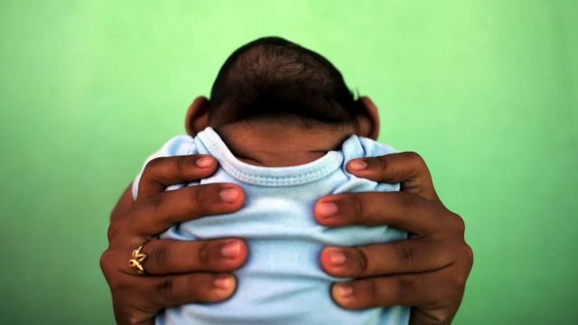 Jackeline tient dans ses bras son fils de quatre mois, qui est né avec une microcéphalie, au Brésil lors de l'épidémie de Zika en 2016