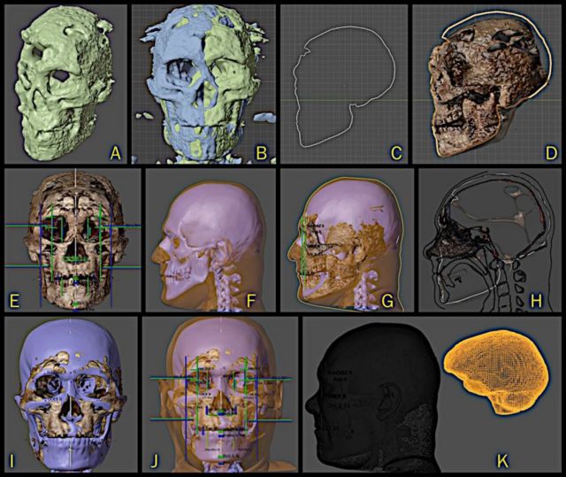 Imagens computadorizadas do crânio