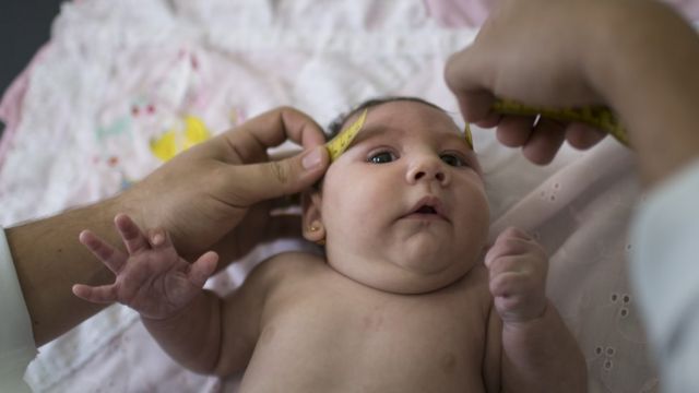 Medição de perímetro cefálico de bebê com microcefalia, em foto de de dezembro de 2015