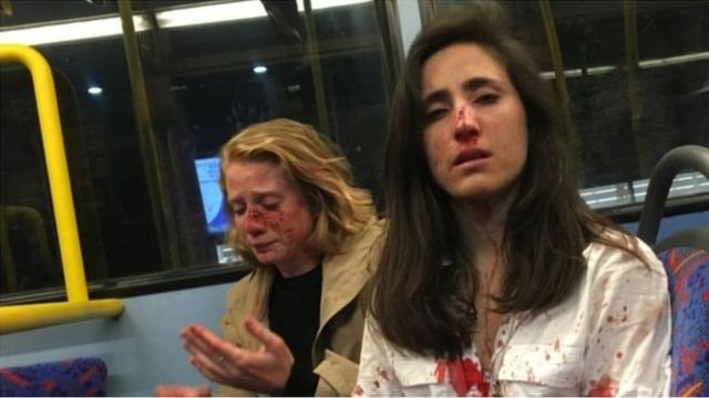 Tiga Pria Mengeroyok Pasangan Lesbian Di Bus Kota Saya Masih Marah Ini Menakutkan Bbc News Indonesia
