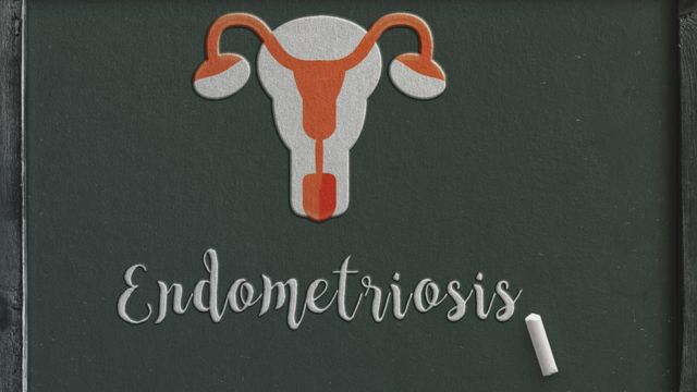 முதன்மையான அறிகுறி பொதுவாக காரணமின்றி ஏற்படும் கடுமையான இடுப்பு வலி ஆகும்.